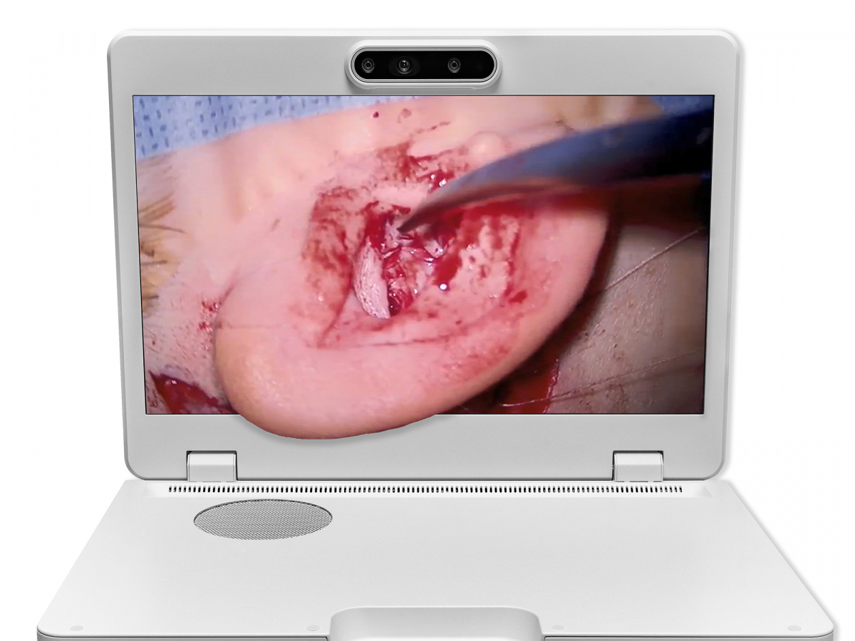 ֮Heads-up 3D΢ʾϵͳ4K3Dʾ׷ϵͳ߱׷ƶλùЧҽʦʱάιƵļ縺ҽʦи3DҰʵִ